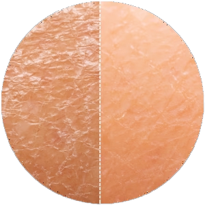 Dry skin before