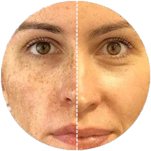 Dark spots before